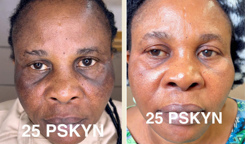 Anti Aging