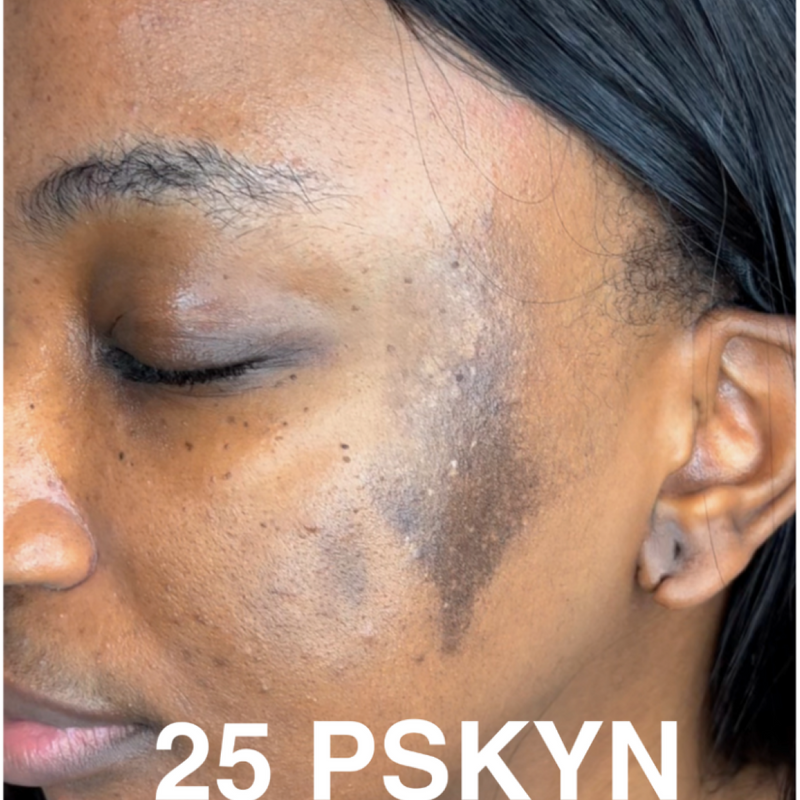 Before treatment