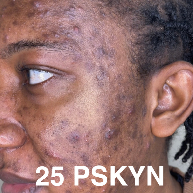 Before treatment