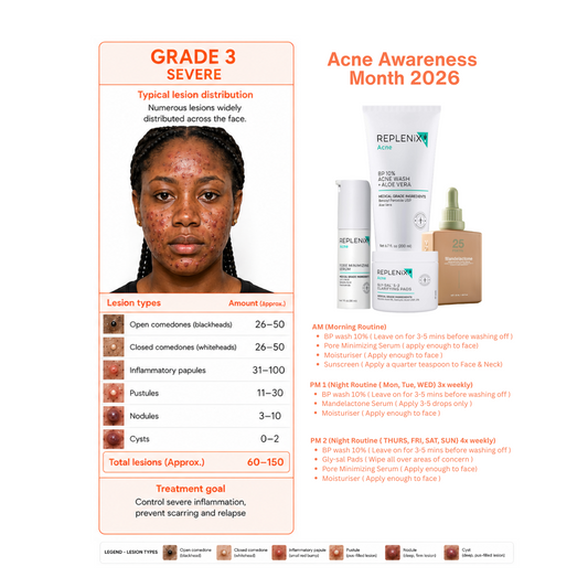 Grade 3 Acne Pack